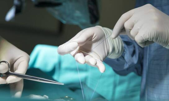 Zalety nici PDO w kontekście bez skalpela liftingu