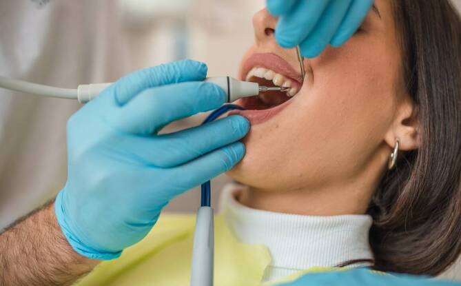 Jakie są najczęstsze metody usuwania nazębnego kamienia?