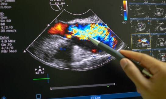 Badanie Doppler tętnic nerkowych jako kluczowy element w diagnostyce nefrologicznej