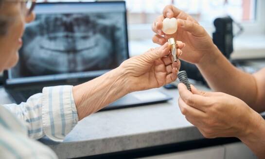 Zastosowanie zębowych implantów w nowoczesnej stomatologii