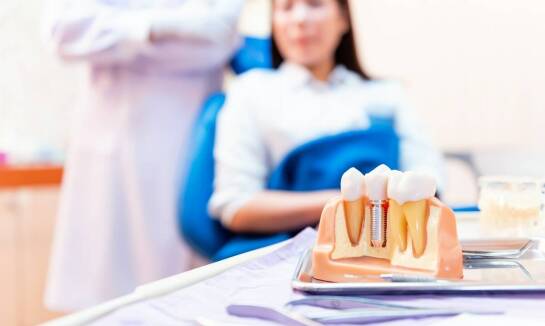 Stomatologiczna implantologia: proces i długoterminowe efekty