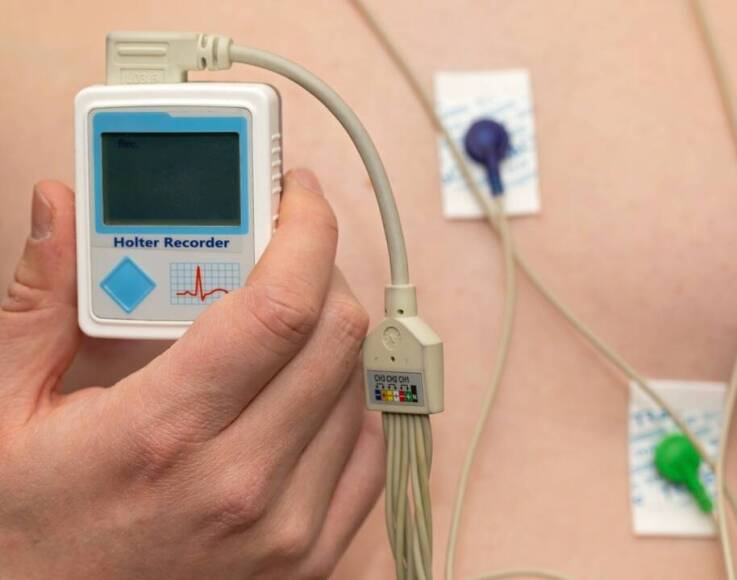 Dlaczego długoterminowe monitorowanie serca jest istotne dla zdrowia?