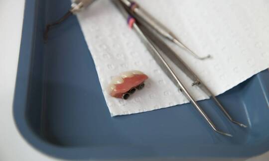 Jak przebiega leczenie protetyczne przy brakach zębowych — od diagnozy do korekty