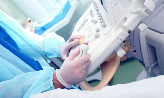 Rola aparatów USG w diagnostyce naczyniowej: kluczowe zastosowania