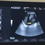 Świadczenia dla kobiet w ciąży bez pracy w 2025 roku