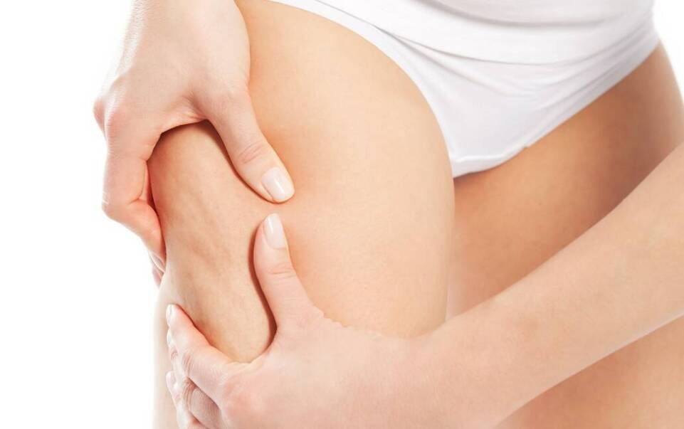 Czy masaż podciśnieniowy może pomóc w walce z cellulitem?