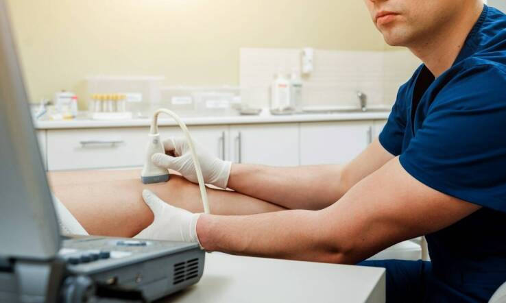 Skleroterapia – jak przygotować się do zabiegu?