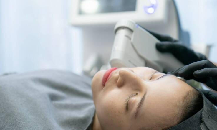 Laserowy lifting twarzy: jak działa i jakie daje efekty?