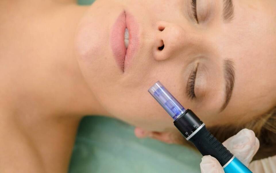 Jak bezpiecznie wykonywać zabiegi dermapenem?