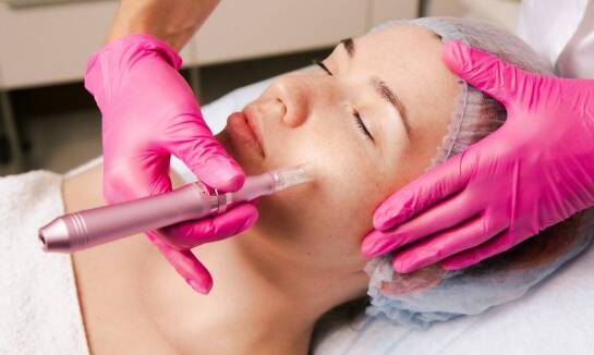 Na czym polega zabieg mezoterapii?