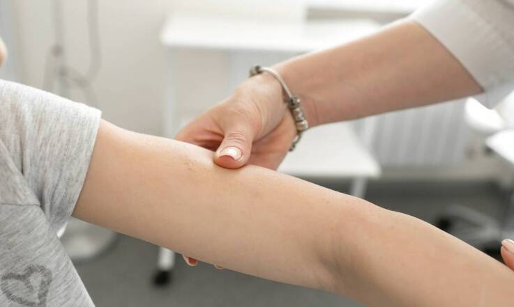 Dlaczego warto wybrać dermatologię w Żyrardowie dla zdrowia swojej skóry?
