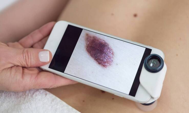 Zastosowanie obrazowania 3D w analizie skóry i planowaniu indywidualnych terapii