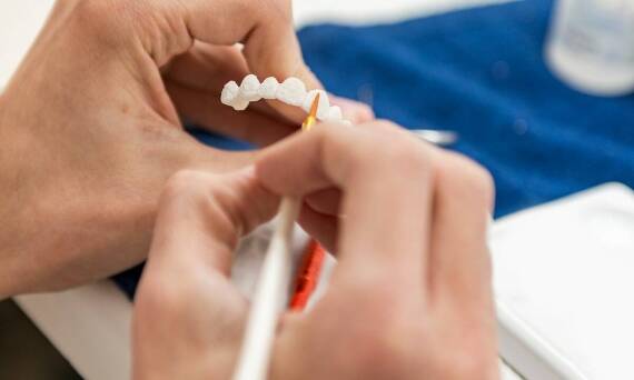 Czym różnią się korony zębowe od mostów i kiedy je stosować?