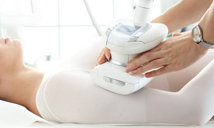 Proces lipolizy – co warto wiedzieć przed zabiegiem?