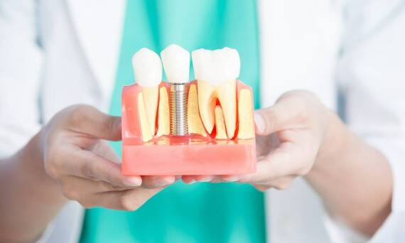 Jakie technologie wspierają sukces implantów natychmiastowych?