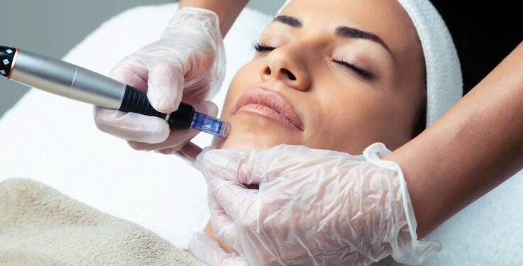 Mezoterapia igłowa – kluczowy zabieg w medycynie estetycznej dla poprawy wyglądu skóry