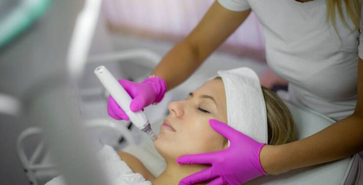 Jakie są zalety zabiegów z użyciem Dermapen?