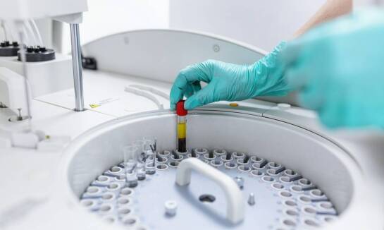 Znaczenie badań krwi w wykrywaniu chorób autoimmunologicznych