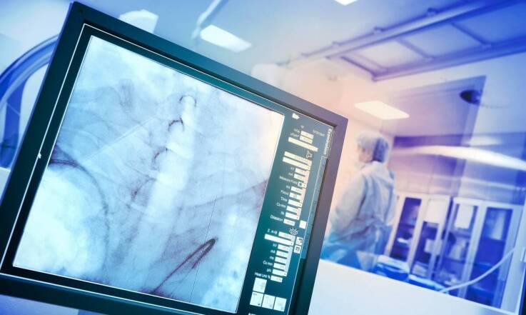 Wpływ angiografii na wykrywanie wczesnych stadiów chorób siatkówki