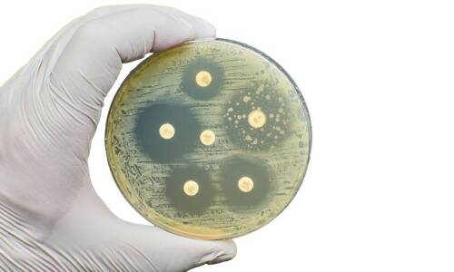 Jakie są zalety stosowania flory bakteryjnej w biologicznych oczyszczalniach?