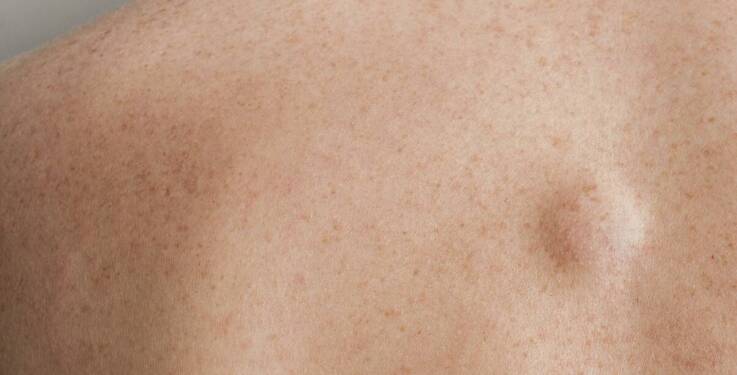 Jakie objawy skórne wymagają konsultacji z dermatologiem?