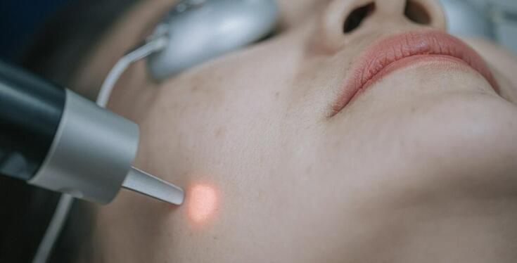 Dlaczego warto postawić na depilację laserową z wykorzystaniem lasera diodowego?