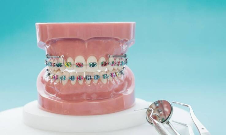 Jakie są najnowsze metody leczenia ortodontycznego dla dorosłych?