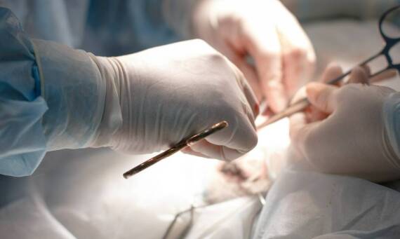 Jakie są różnice między metodą FUE a innymi technikami transplantacji?