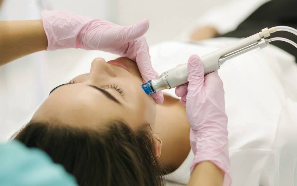 Jakie substancje aktywne są używane w mezoterapii mikroigłowej?