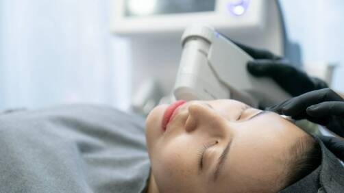 Zalety laserowego usuwania makijażu permanentnego – co warto wiedzieć?