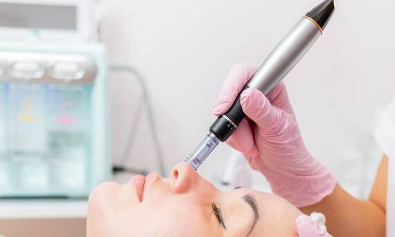 Mezoterapia mikroigłowa: dlaczego skóra staje się czerwona i podrażniona?