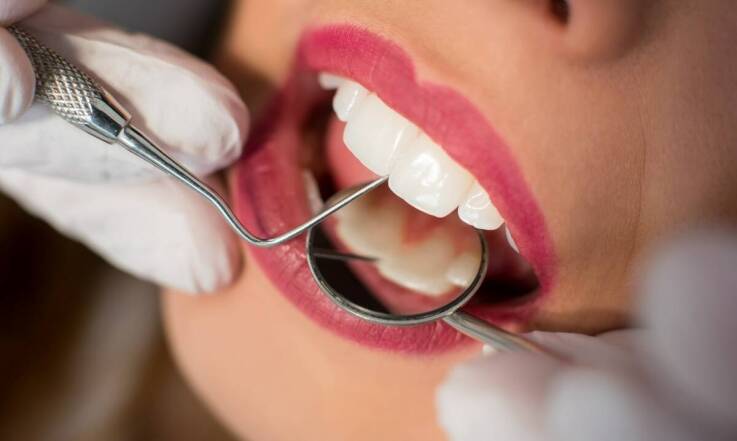 Zalety bondingu zębów w porównaniu do innych metod odbudowy estetycznej