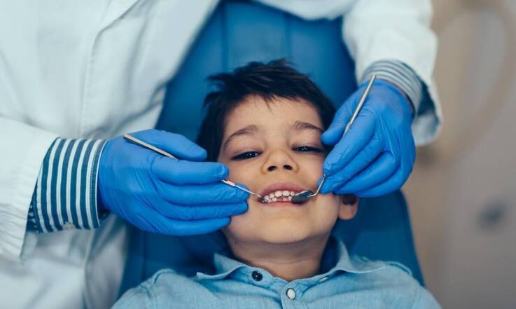 Co warto wiedzieć o lakowaniu bruzd zębowych u dzieci i dorosłych?