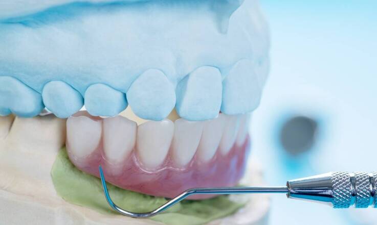 Jakie są różnice między tradycyjnymi a nowoczesnymi metodami wykonania protez?