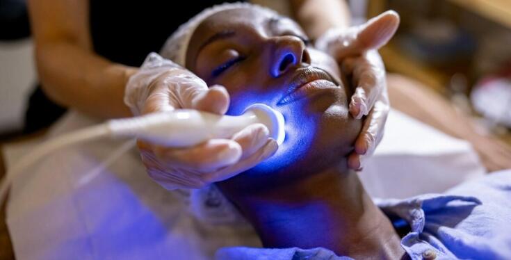 Porównanie nici PDO z innymi metodami liftingu twarzy