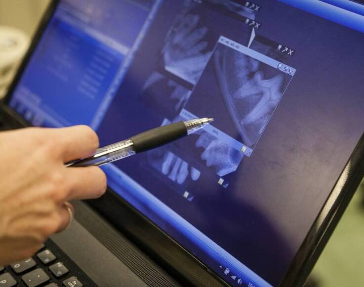 Co obrazuje RTG zębów?