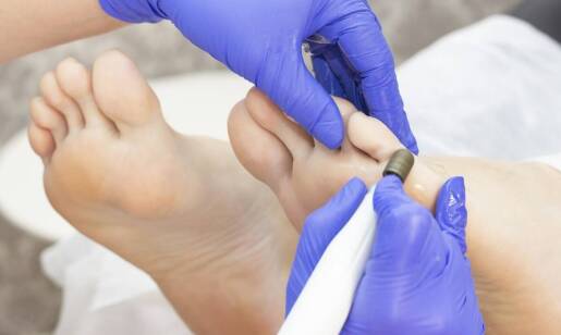 Dlaczego z wrastającym paznokciem warto udać się do podologa?