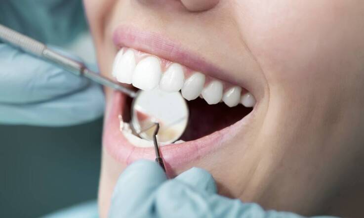 Jakie są najczęstsze przyczyny przebarwień zębów i jak je eliminować?