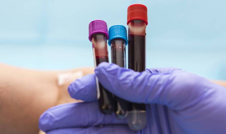 Jakie badania dla wegetarian są szczególnie istotne dla zdrowia?