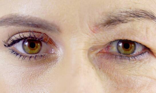 Czy zabieg na opadające powieki jest odpowiedni dla Ciebie?