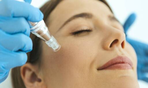 Mezoterapia igłowa a odżywienie skóry – jakie składniki są kluczowe?