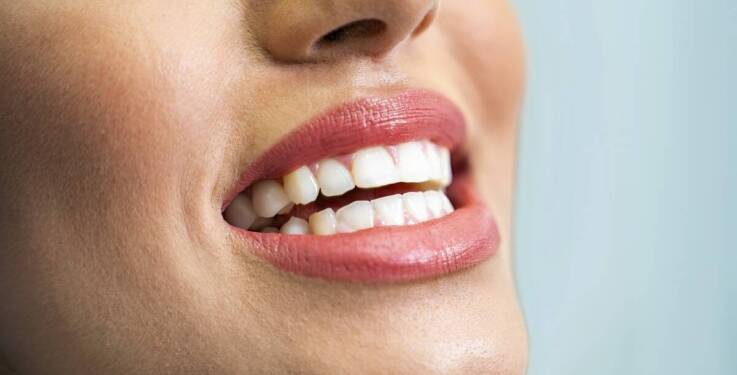 Białe przebarwienia na zębach - co mogą oznaczać?