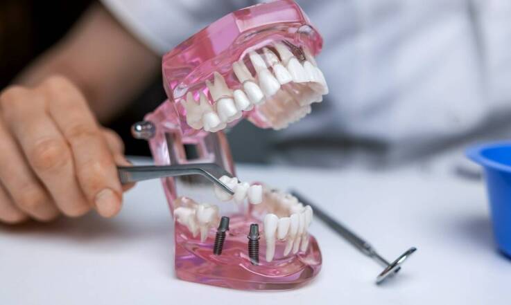 Periodontologiczne metody wspomagające leczenie implantologiczne