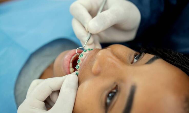 Jakie są etapy leczenia ortodontycznego od diagnozy po zdjęcie aparatu?