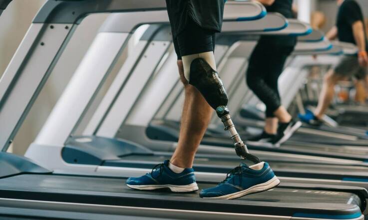 Jakie korzyści niesie za sobą zakup sprzętu ortopedycznego z refundacją