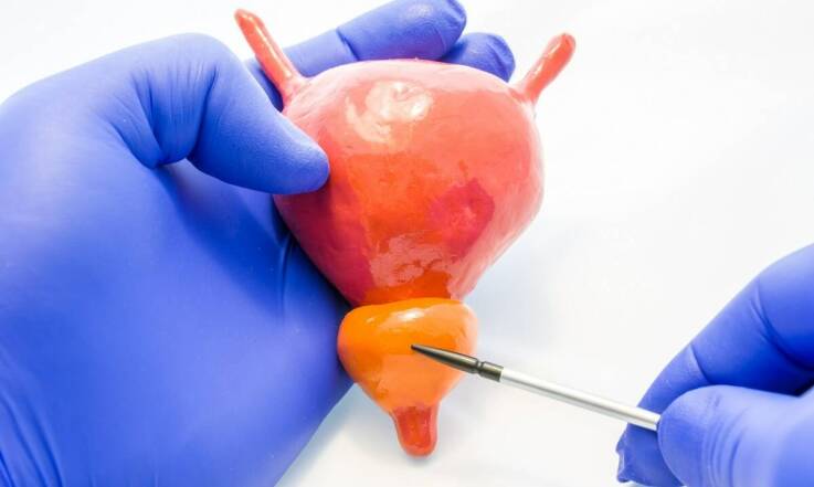 Rola cystoskopii w leczeniu kamicy pęcherza moczowego