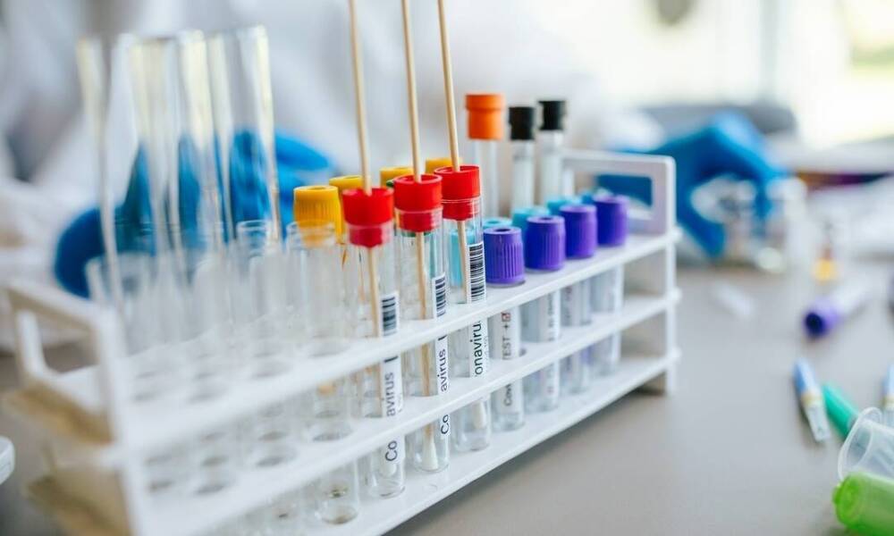 Jak powstają probówki do wymazów?