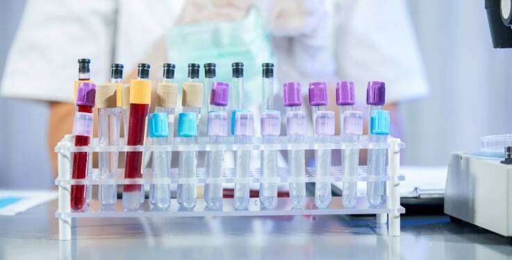 Jakie badania diagnostyczne są kluczowe w leczeniu chorób wewnętrznych?