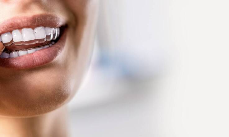 Jakie efekty można osiągnąć dzięki leczeniu aparatami ortodontycznymi?