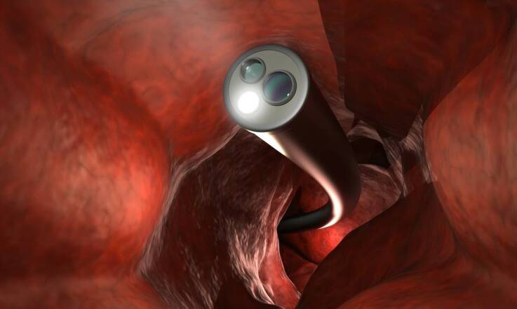 Endoskopia w placówce Lar-Med – badania medyczne